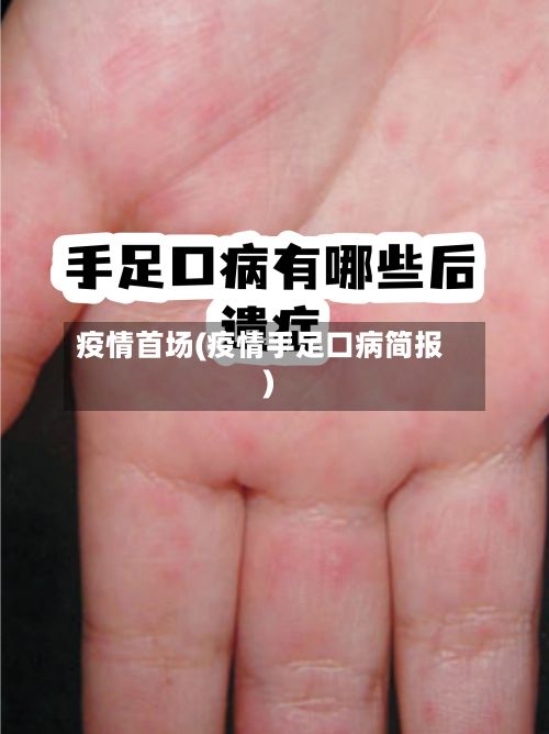 疫情首场(疫情手足口病简报)