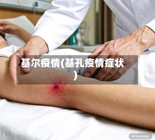 基尔疫情(基孔疫情症状)-第3张图片