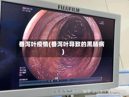 番泻叶疫情(番泻叶导致的黑肠病)