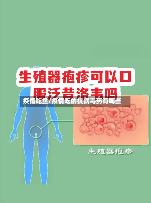 疫情吃鱼/疫情吃的抗病毒药有哪些-第3张图片