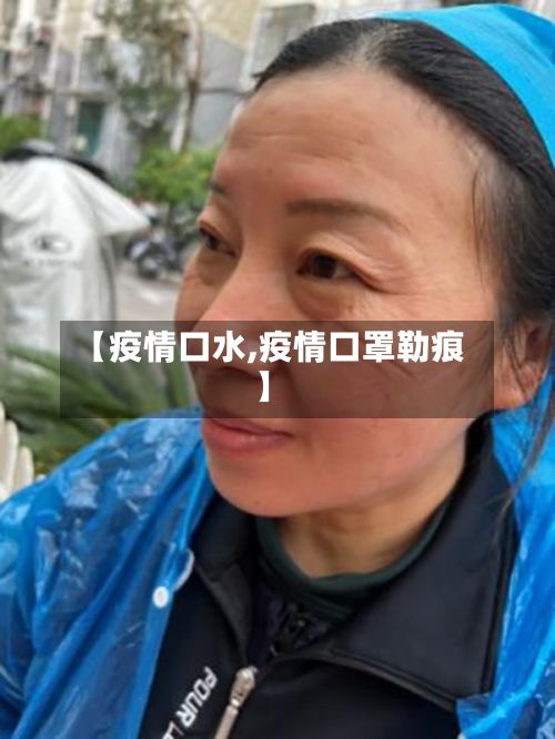 【疫情口水,疫情口罩勒痕】-第2张图片