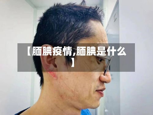 【腼腆疫情,腼腆是什么】-第2张图片