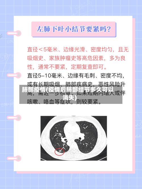 肺部疫情(疫情后肺部结节多久可以消失)
